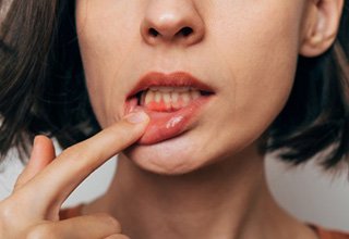 Young man laughing holding Invisalign with off-white background