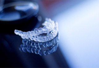 Aligner trays that signify the cost of Invisalign in Owasso