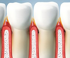 illustration of teeth and gums