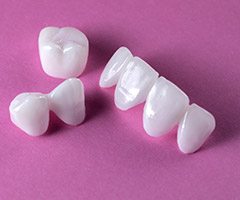 Dental Crowns and bridges