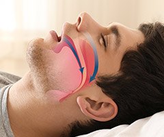 man sleeping with airway arrows