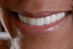 Owasso porcelain veneers