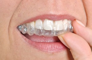 invisalign owasso