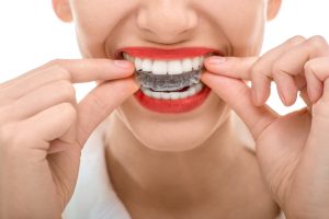 Adults and teens choose Invisalign clear aligners for orthodontic treatment in Owasso. Comfortable and discreet, Invisalign straightens smiles quickly. 